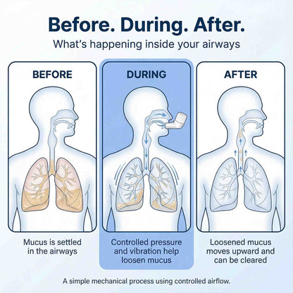 Pulmonex™ Mechanical Device for Mucus Clearance